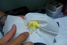Close-up of hands holding audiology equipment on a white cloth