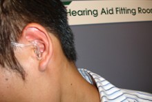Close-up of a client's ear with hearing aid