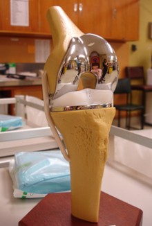 An artificial limb